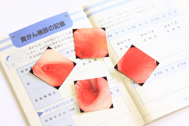 上部消化管内視鏡検査（胃カメラ）